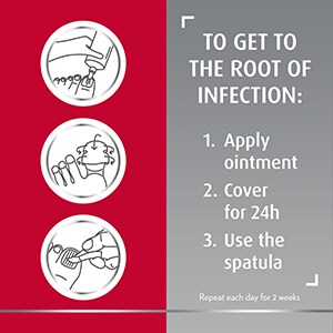 Canespro three-step fungal nail treatment icons with caption 1. apply ointment 2. cover for 24h 3. use the spatula. repeat every day for 2 weeks 